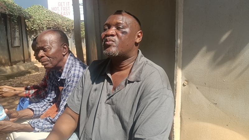 Ham Mukasa Galabuzi at Mukono Police after sustaning injuries